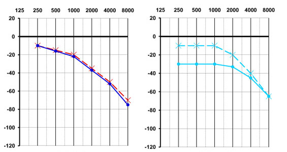 audiogramme2